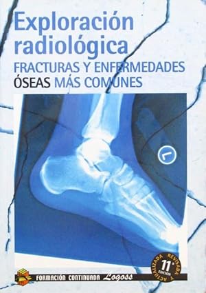 EXPLORACION RADIOLOGICA: FRACTURAS Y ENFERMEDADES OSEAS MAS COMUNES. (Como nuevo)