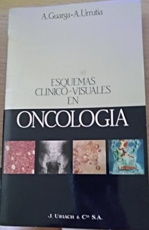 ESQUEMAS CLINICO VISUALES EN ONCOLOGIA.