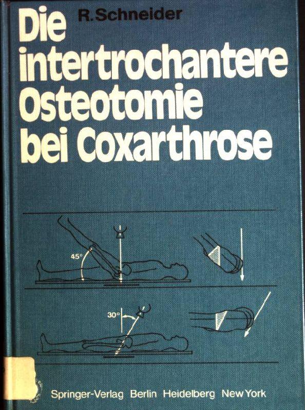 Die intertrochantere Osteotomie bei Coxarthrose - Schneider, Robert
