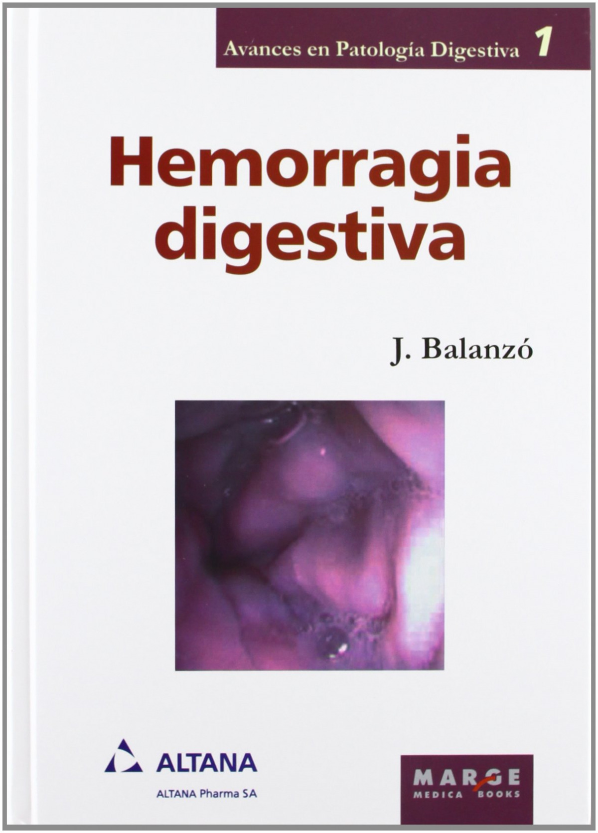 Hemorragia digestiva - Balanzo Tintore, Joaquim