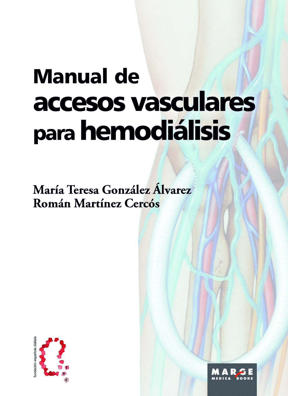 Manual de accesos vasculares par - Gonzalez Alvarez, Mªteresa