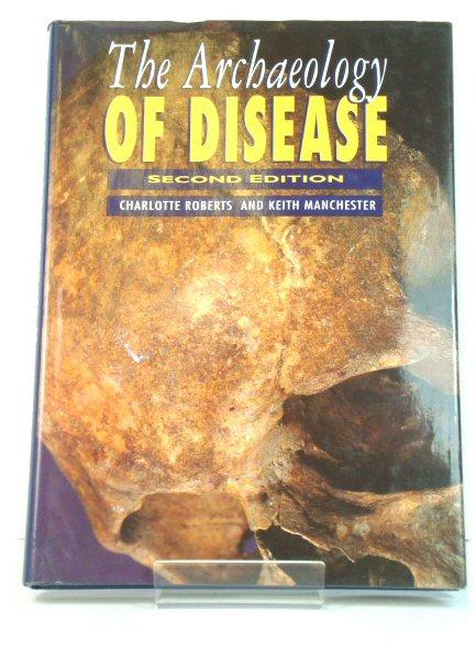 The Archaeology of Disease - Manchester, Keith; Roberts, Charlotte