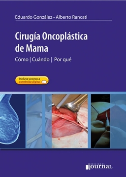 CIRUGIA ONCOPLASTICA DE MAMA - González, E. - Rancati, A.