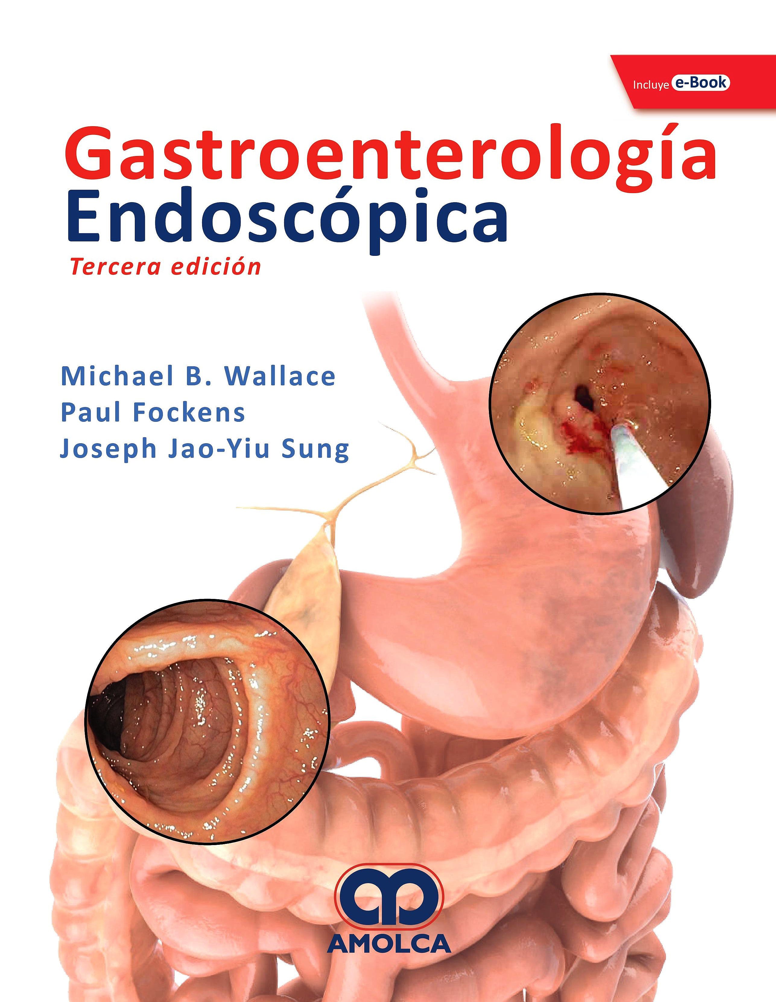 Gastroenterología Endoscópica