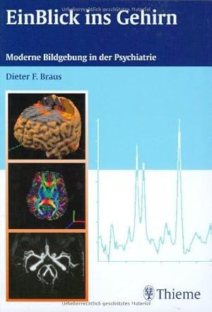 Ein Blick ins Gehirn : Bildgebung in der modernen Psychiatrie ; 21 Tabellen.