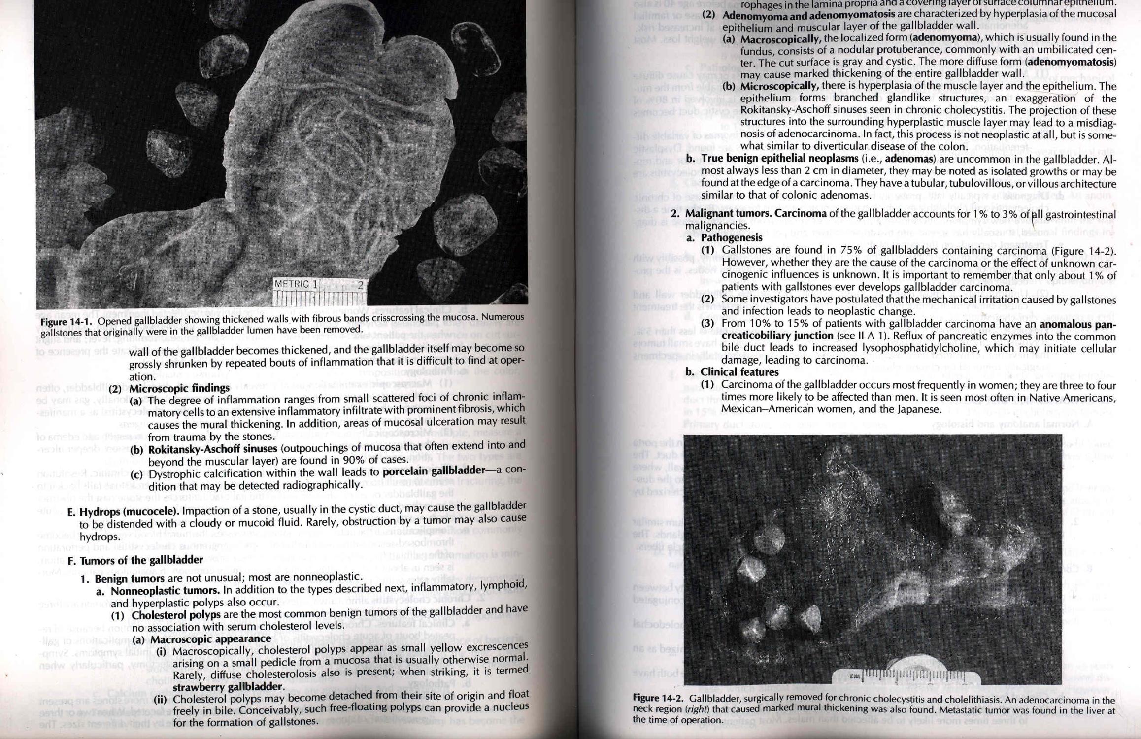 Pathology [National medical series for independent study] [Inflammation -- Special diagnostic techniques -- Neoplasia -- Environmental pathology -- Nutritional pathology -- Immunopathology -- Transplantation -- Hematopoietic and lymphatic systems -- Haart -- Vascular system -- Lung -- Mediastinum -- Gatrointestinal tract -- Biliary tract and exocrine pancreas -- Liver -- Kidney and Urinary tract -- Male reproductive system -- Female reproductive system -- Breast -- Endocrine system -- Nervous system -- Head and neck -- Bones and joints -- Skin -- Soft tissues -- Comprehensive exam][Outline for course study and USMLE preparation; 500 Board-type questions with annotated answers] - Livolsi, Virginia A. [Maria J Merino, John S J Brooks, Scott H Saul, John E. Tomaszewski; Debra Dreger, JAne Velker, Joan Leary, Anne Praino