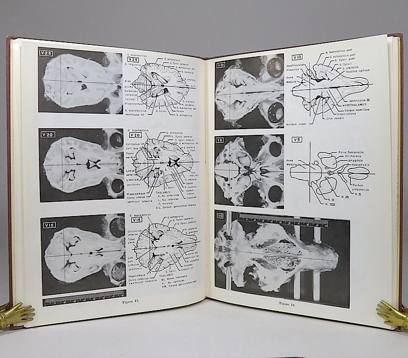 A Stereotaxic Atlas of the Dog's Brain. by Lim, Robert K. S.; Chan-Nao ...