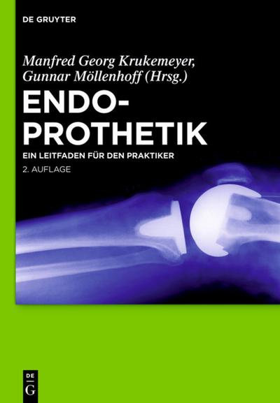 Endoprothetik : Ein Leitfaden für den Praktiker - Gunnar Möllenhoff