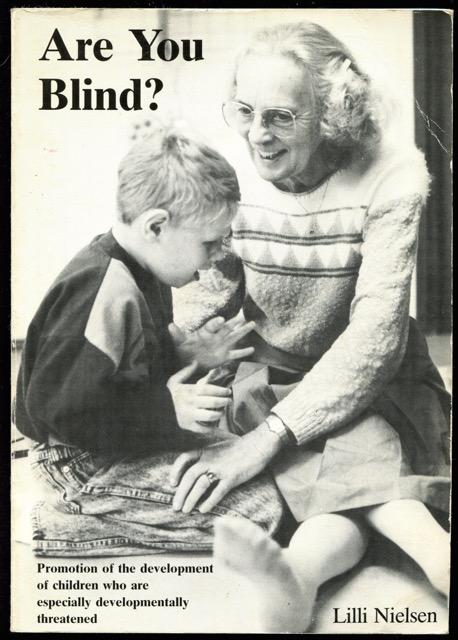Are you blind? : promotion of the development of children who are especially developmentally threatened. - Nielsen, Lilli