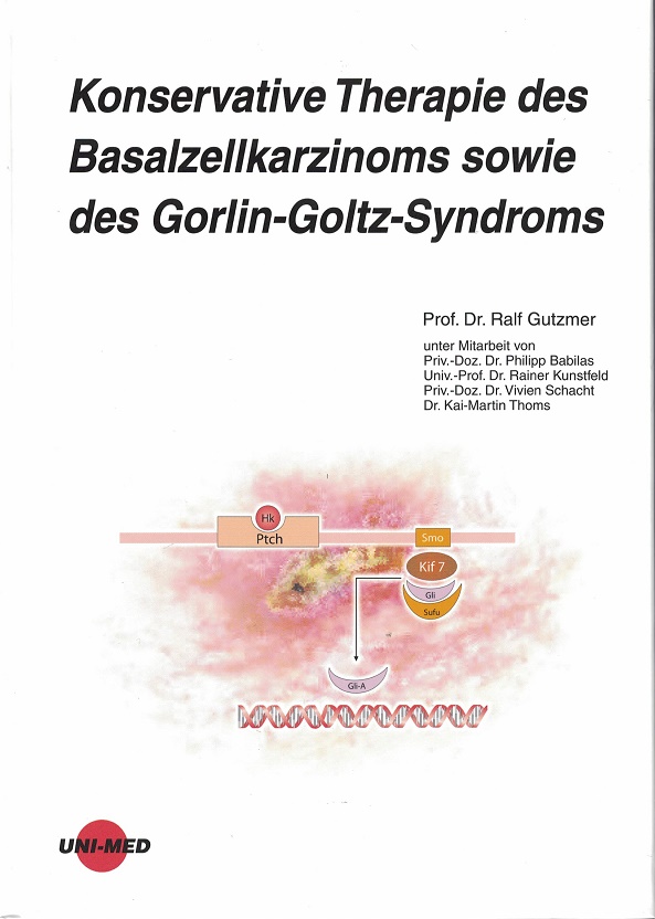 Konservative Therapie des Basalzellkarzinoms sowie des Gorlin-Goltz-Syndroms. [Ralf Gutzmer. Unter Mitarb. von Philipp Babilas .] / UNI-MED science - Gutzmer, Ralf (Hrsg.)