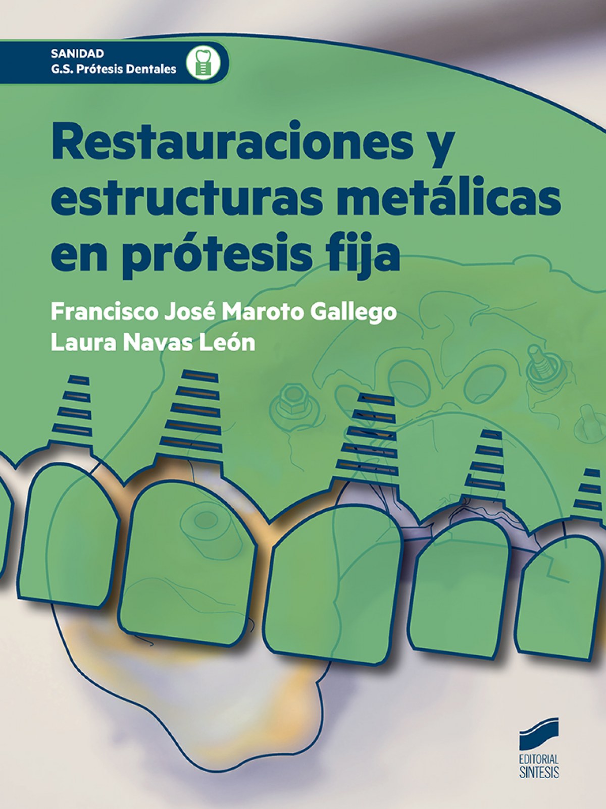 Restauraciones y estructuras metalicas en protesis fija - Vv.Aa.