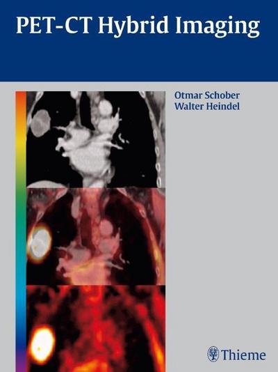 PET-CT Hybrid Imaging - Otmar Schober