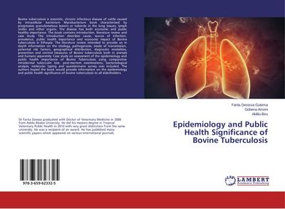 Epidemiology and Public Health Significance of Bovine Tuberculosis - Fanta Desissa Gutema