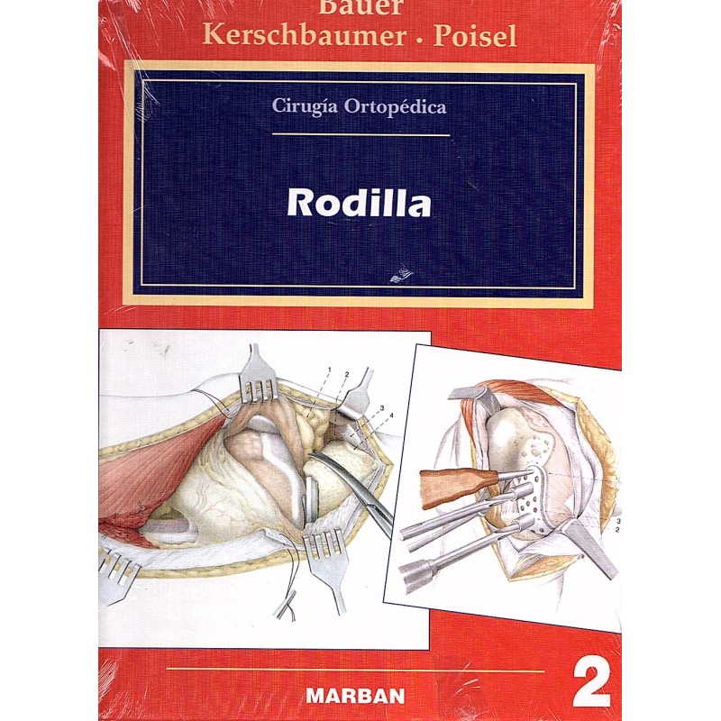 CIRUGÍA ORTOPÉDICA. RODILLA - BAUER KERSCHBAUMER