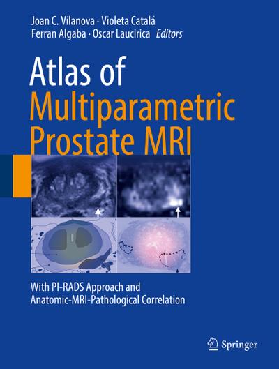 Atlas of Multiparametric Prostate MRI : With PI-RADS Approach and Anatomic-MRI-Pathological Correlation - Joan C. Vilanova