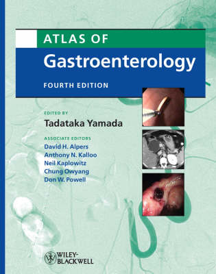 Atlas of Gastroenterology - Yamada Tadataka