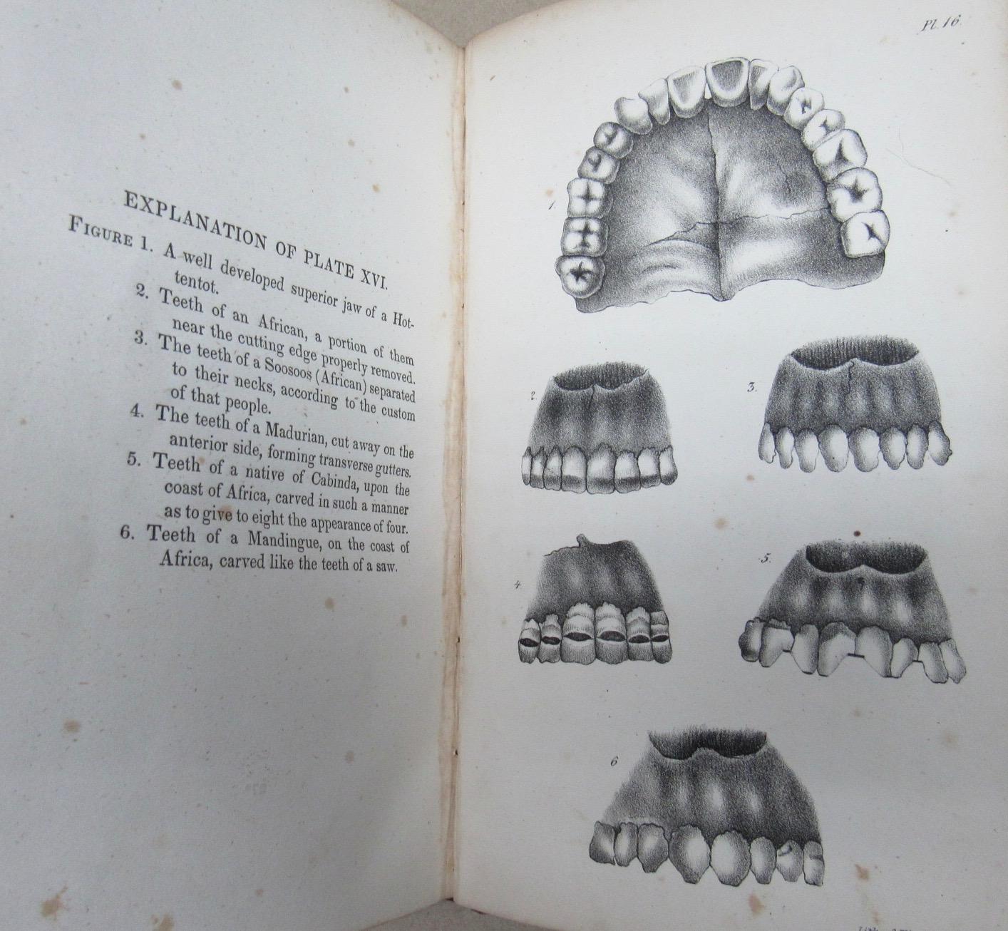 TREATISE ON THE DENTAL ART by Maury Very Good Hardcover (1843) 1st