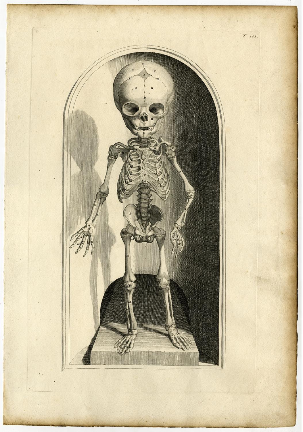ML12 Vintage 1800's Medical Human Adult Infant Child Skull Poster RePrint A2/A3 