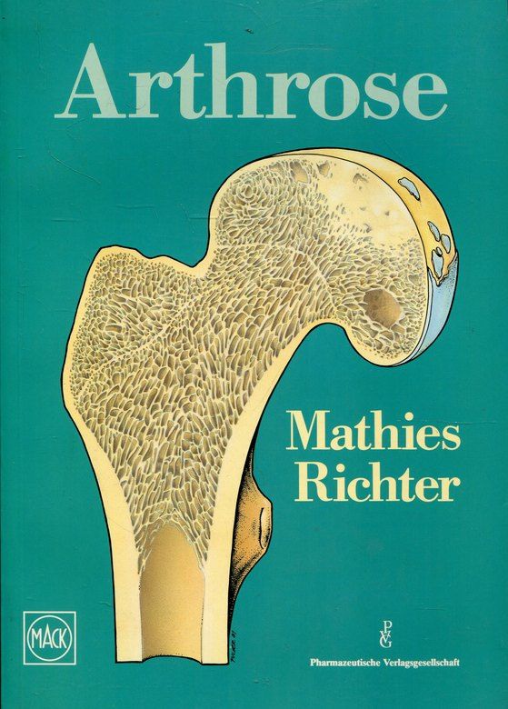 Arthrose am Beispiel des Hüftgelenkes - Mathies, H. und E. Richter