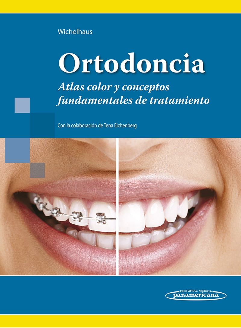 Ortodoncia. Atlas color y conceptos fundamentales de tratamiento - Andrea Wichelhaus