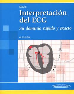 Interpretación del ECG - Dale Davis: RCT