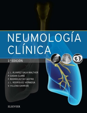 Neumología clínica - osé Luis Álvarez-Sala Walther, Pere Casan Clarà, Felipe Rodríguez de Castro, Juan Luis Rodríguez Hermosa and Victoria Villena Garrido