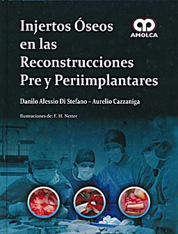 INJERTOS OSEOS EN LAS RECONSTRUCCIONES PRE Y PERIIMPLANTARES - Di Stefano, D.