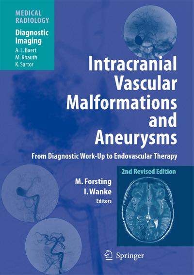 Intracranial Vascular Malformations and Aneurysms : From Diagnostic Work-Up to Endovascular Therapy - Isabel Wanke