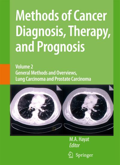 Methods of Cancer Diagnosis, Therapy and Prognosis : General Methods and Overviews, Lung Carcinoma and Prostate Carcinoma - M. A. Hayat