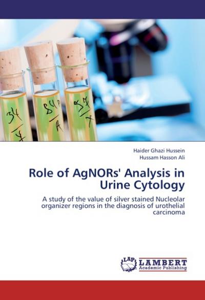 Role of AgNORs' Analysis in Urine Cytology : A study of the value of silver stained Nucleolar organizer regions in the diagnosis of urothelial carcinoma - Haider Ghazi Hussein