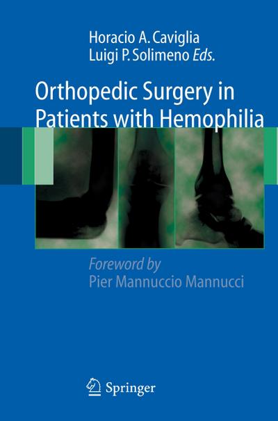 Orthopedic Surgery in Patients with Hemophilia - Horacio A. Caviglia
