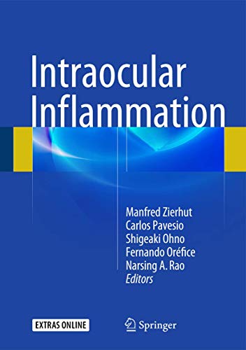 Intraocular Inflammation [Hardcover ]