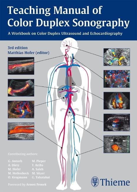 Teaching Manual of Color Duplex Sonography - Matthias Hofer