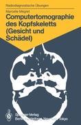 Computertomographie des Kopfskeletts (Gesicht und Schaedel) - Marcelle Megret