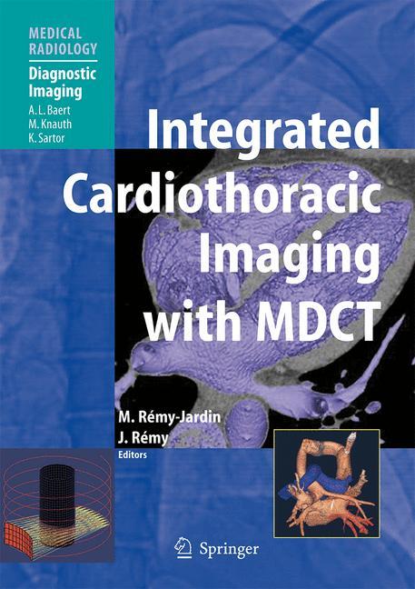Integrated Cardiothoracic Imaging with MDCT - Remy-Jardin, Martine|Remy, Jacques