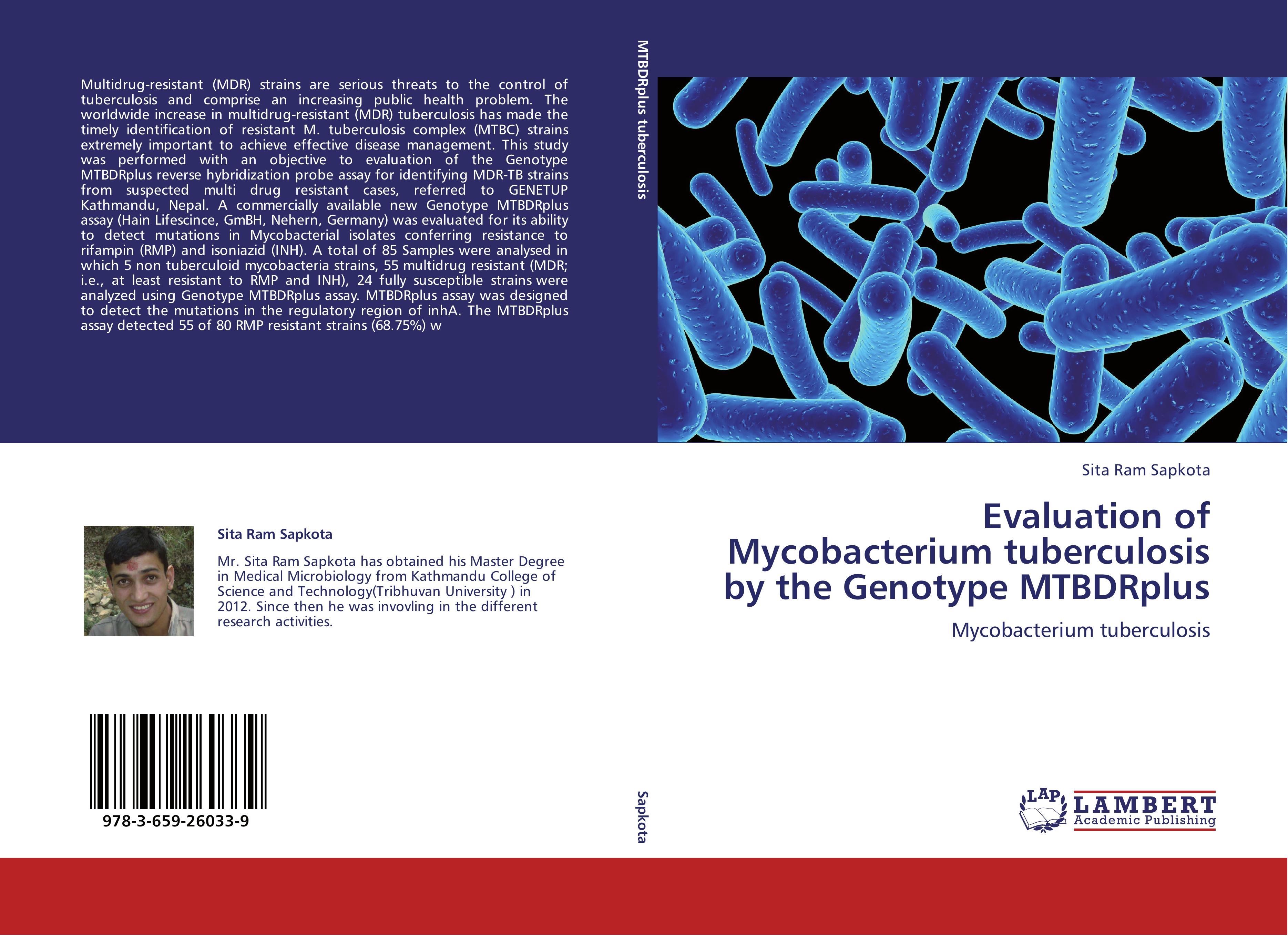 Evaluation of Mycobacterium tuberculosis by the Genotype MTBDRplus - Sita Ram Sapkota