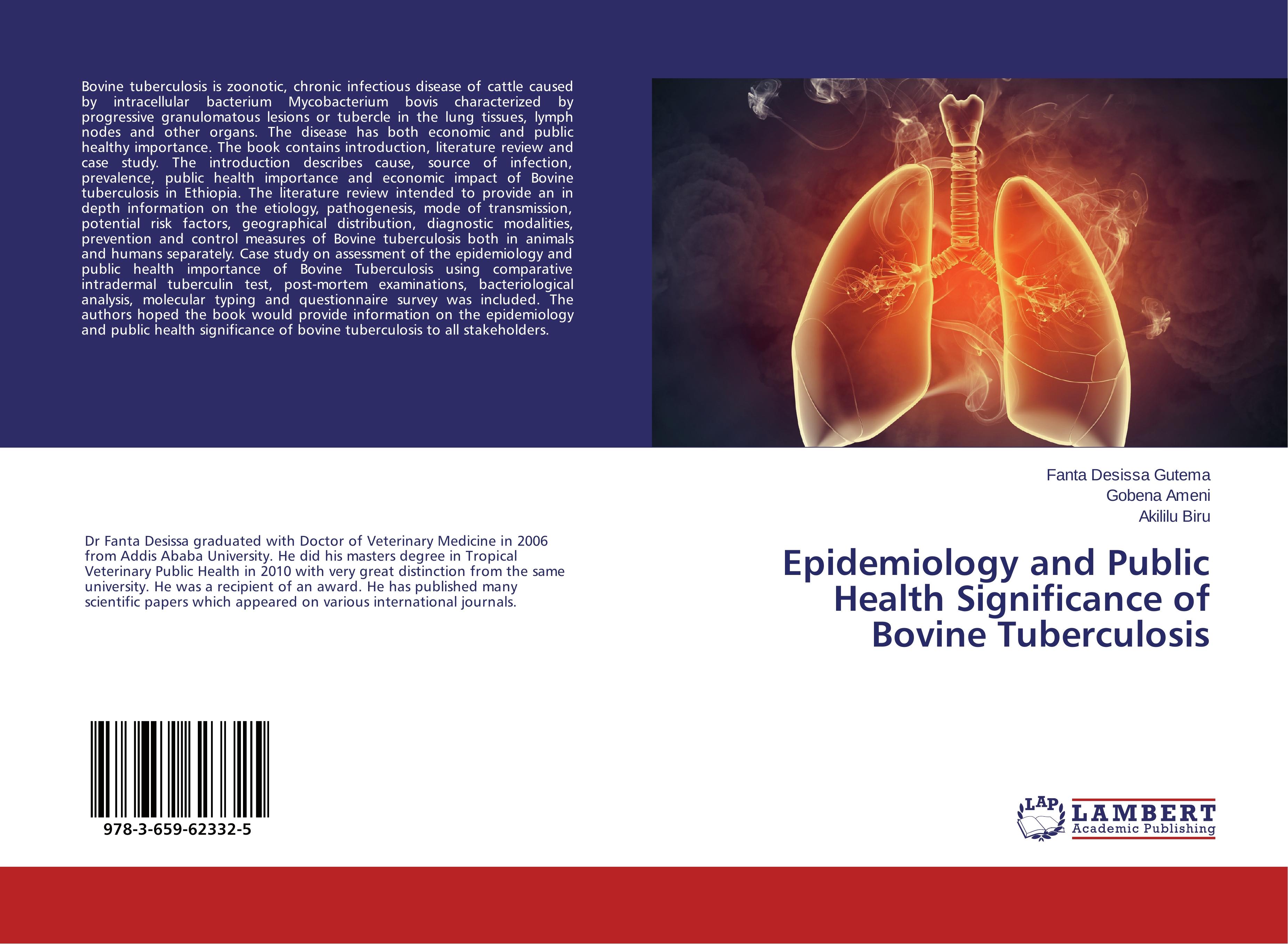 Epidemiology and Public Health Significance of Bovine Tuberculosis - Desissa Gutema, Fanta|Ameni, Gobena|Biru, Akililu