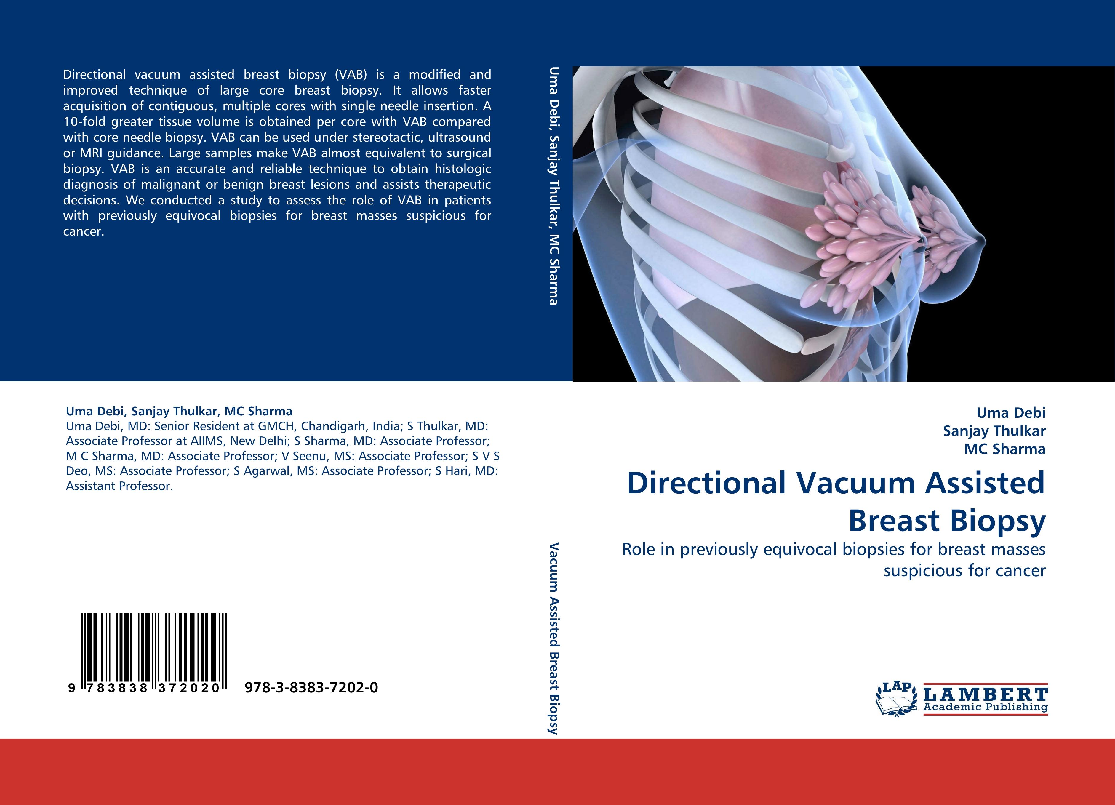 Directional Vacuum Assisted Breast Biopsy - Uma Debi|Sanjay Thulkar|MC Sharma