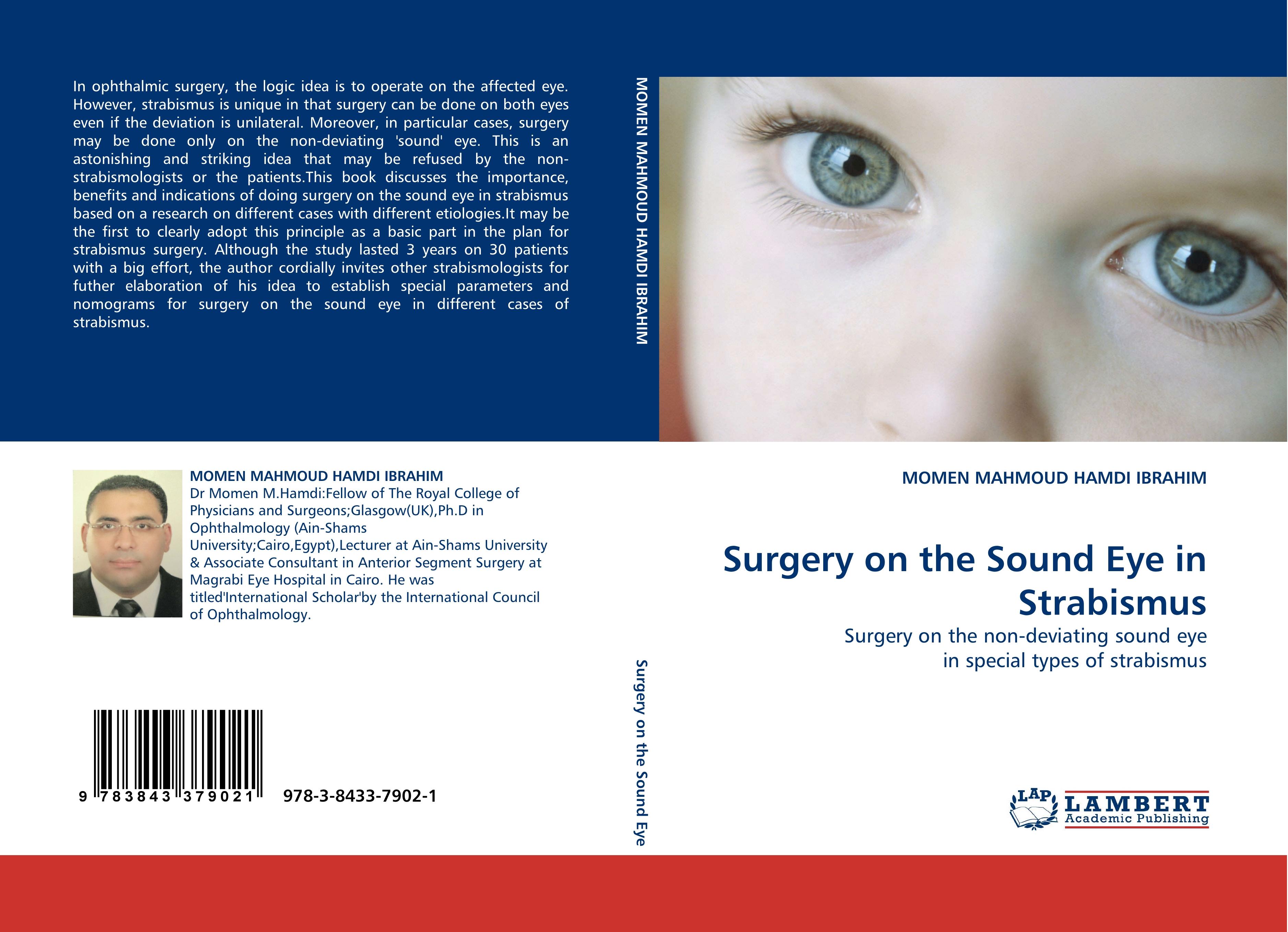 Surgery on the Sound Eye in Strabismus - MOMEN MAHMOUD HAMDI IBRAHIM