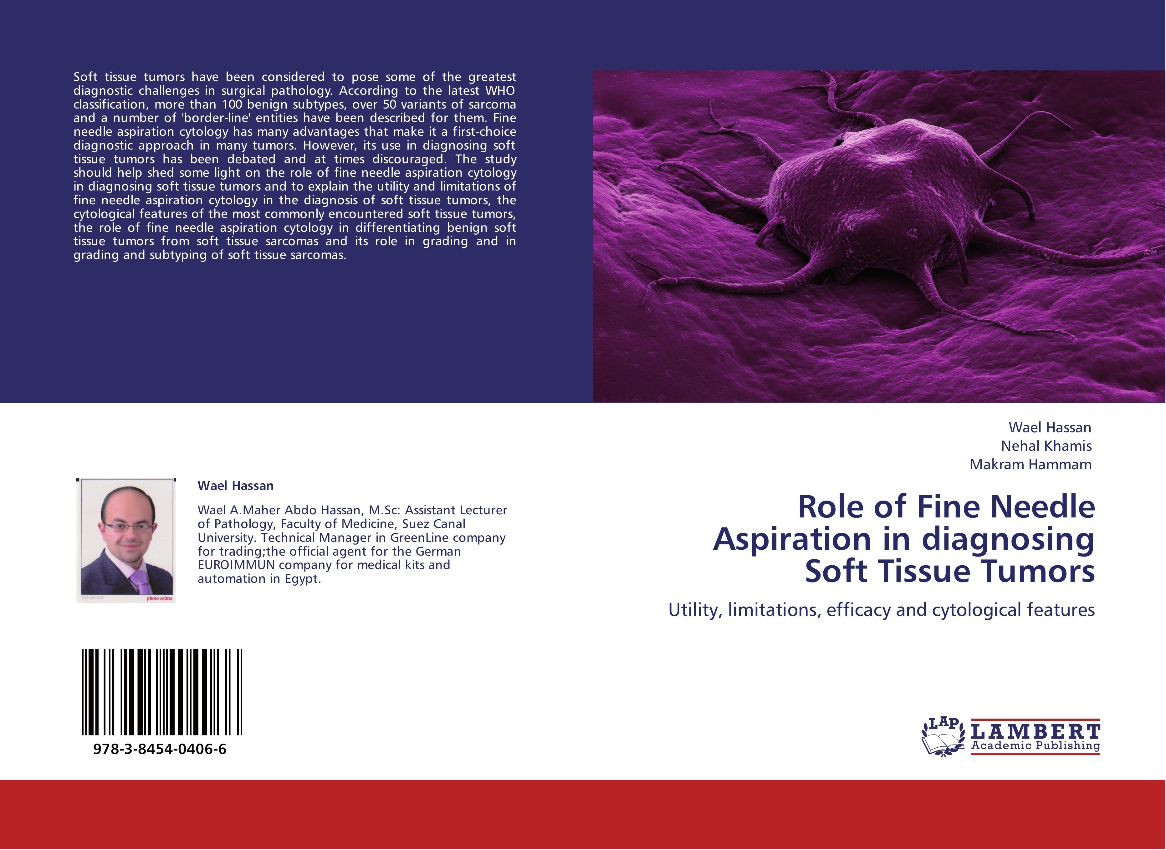 Role of Fine Needle Aspiration in diagnosing Soft Tissue Tumors - Wael Hassan|Nehal Khamis|Makram Hammam
