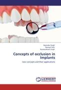 Concepts of occlusion in Implants - Barjinder Singh|Navreet Sohi|Karanprakash Singh