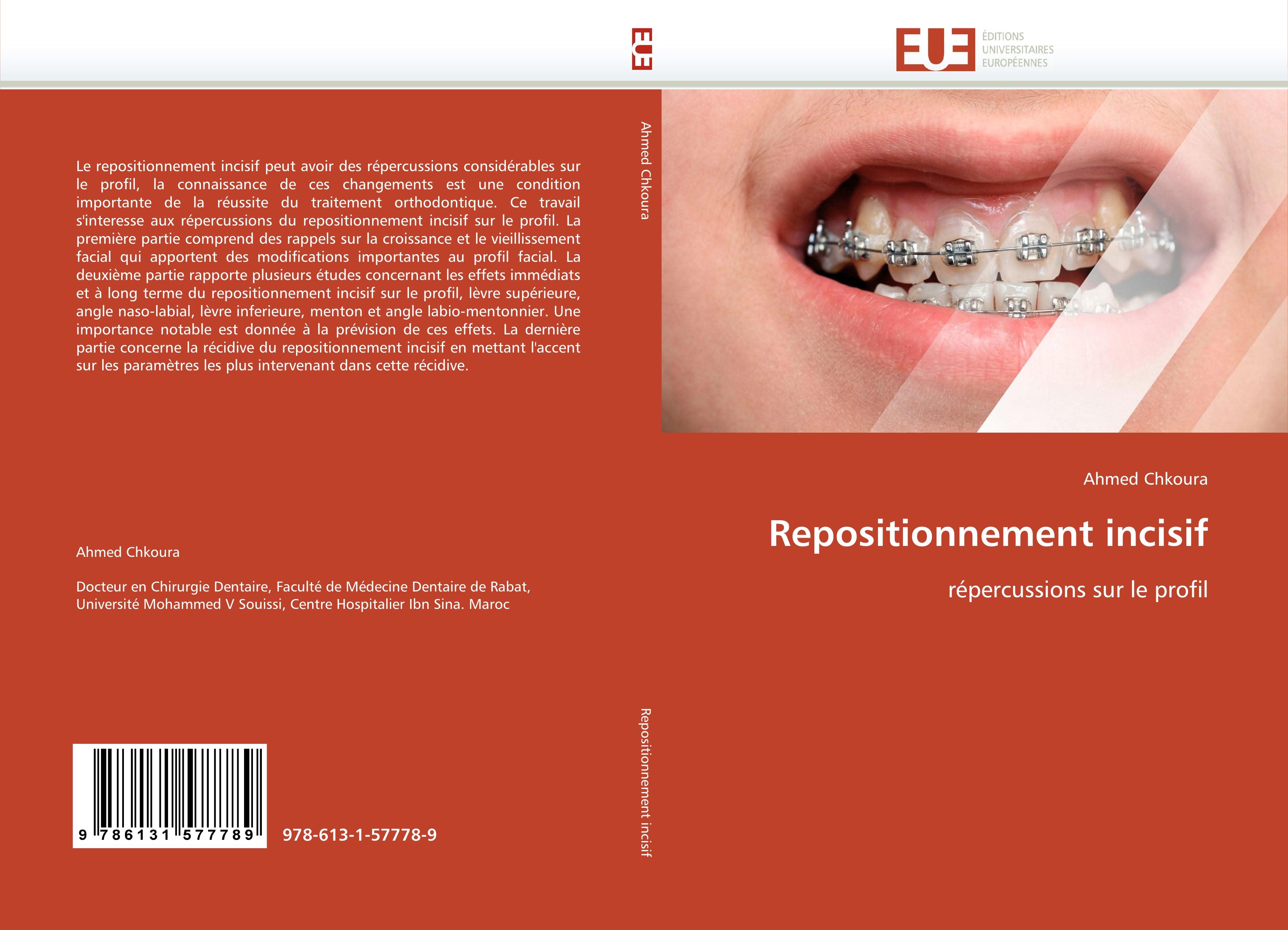 Repositionnement incisif - Ahmed Chkoura