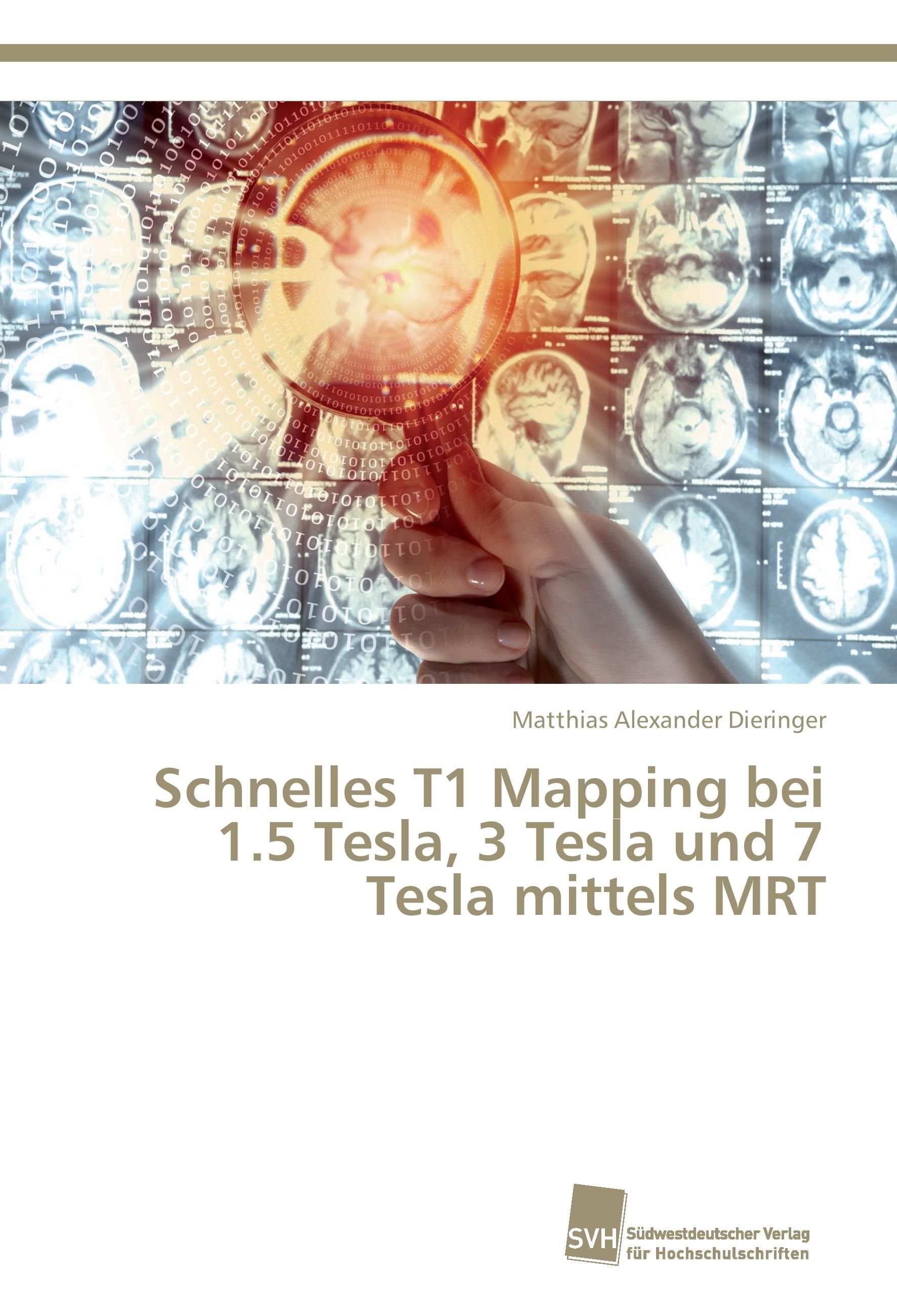 Schnelles T1 Mapping bei 1.5 Tesla, 3 Tesla und 7 Tesla mittels MRT - Matthias Alexander Dieringer