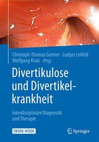 Divertikulose und Divertikelkrankheit - Germer, Christoph-Thomas|Leifeld, Ludger|Kruis, Wolfgang