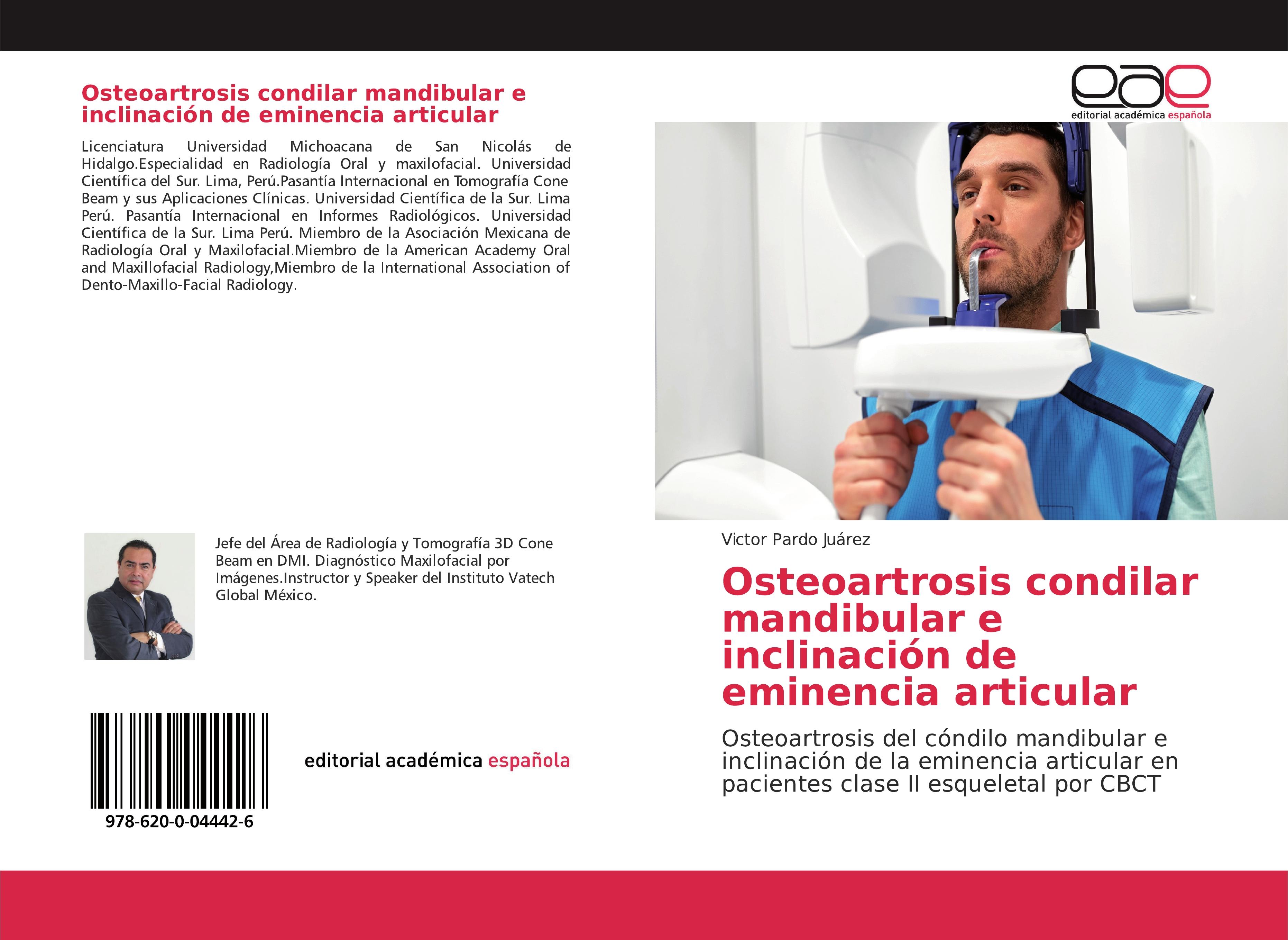 Osteoartrosis condilar mandibular e inclinaciÃƒÂ³n de eminencia articular - Victor Pardo JuÃƒÂ¡rez