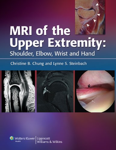 Mri of the Upper Extremity: Shoulder, Elbow, Wrist, and Hand - Steinbach, Lynne S