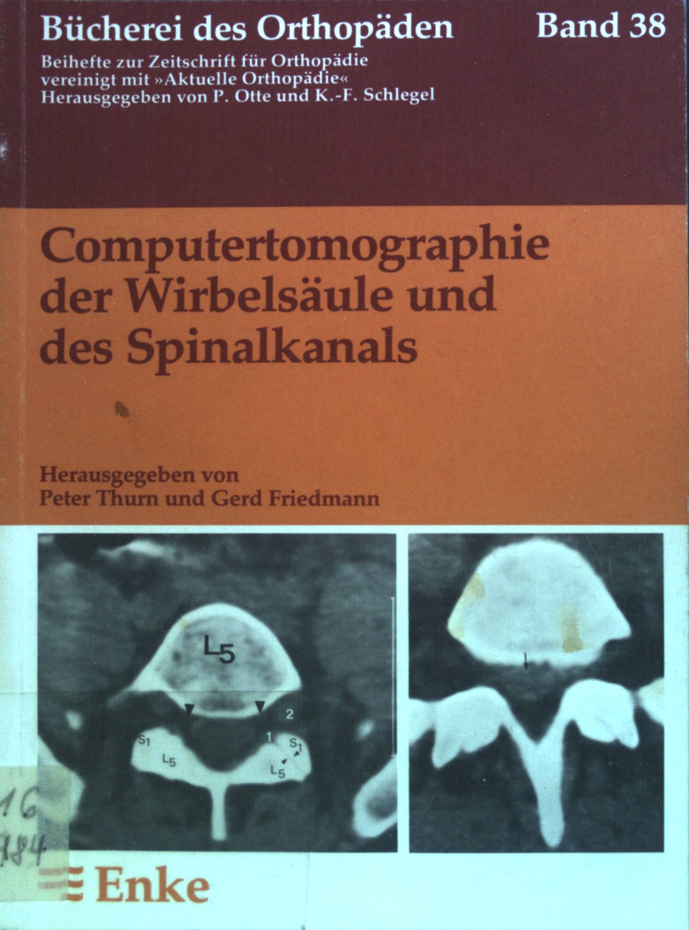 Computertomographie der Wirbelsäule und des Spinalkanals. Bücherei des Orthopäden ; Bd. 38 - Thurn, Peter und Klaus Lackner