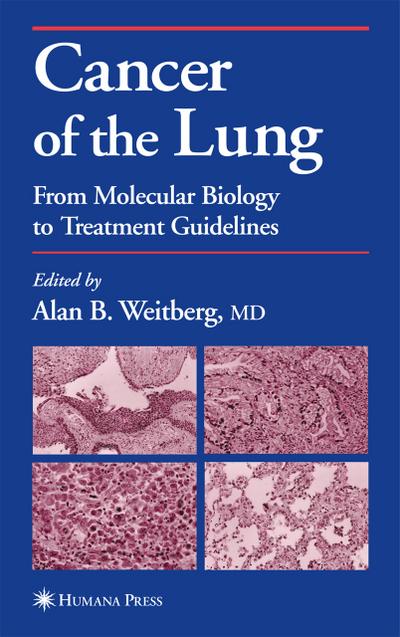 Cancer of the Lung : From Molecular Biology to Treatment Guidelines - Alan Weitberg