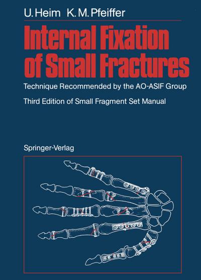 Internal Fixation of Small Fractures : Technique Recommended by the AO-ASIF Group - Karl M. Pfeiffer