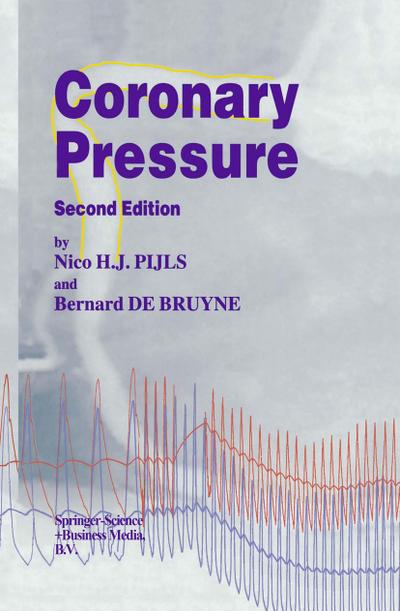 Coronary Pressure - B. De Bruyne